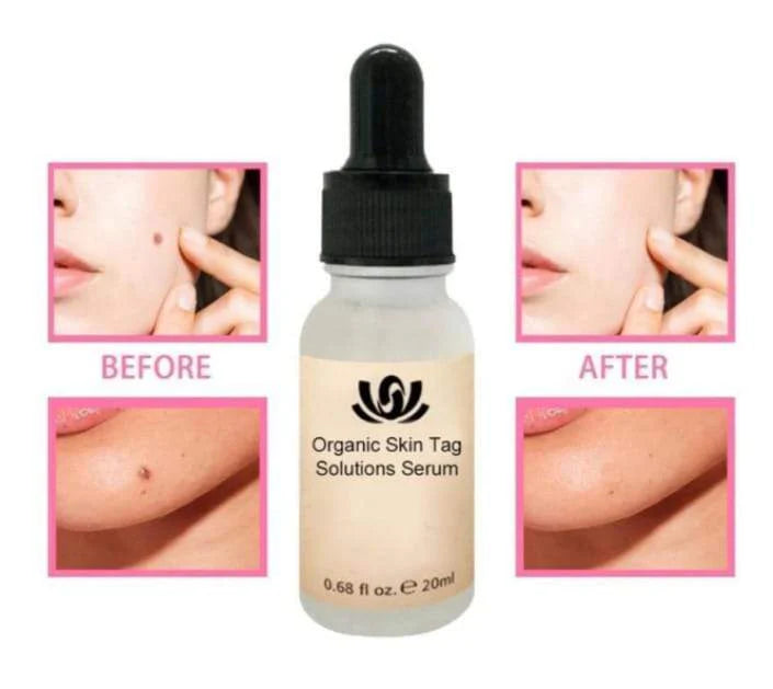 Natural Spots Free Serum