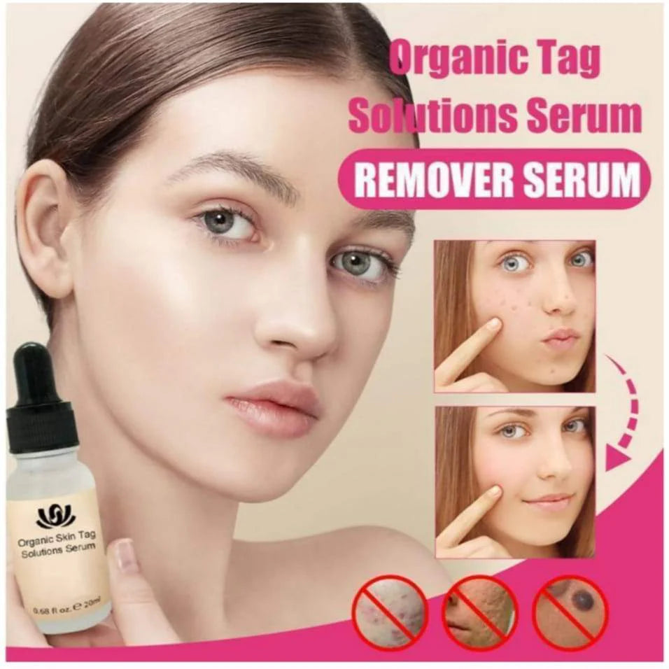 Natural Spots Free Serum