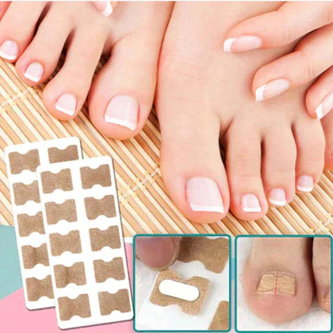 Nail Correction Patches