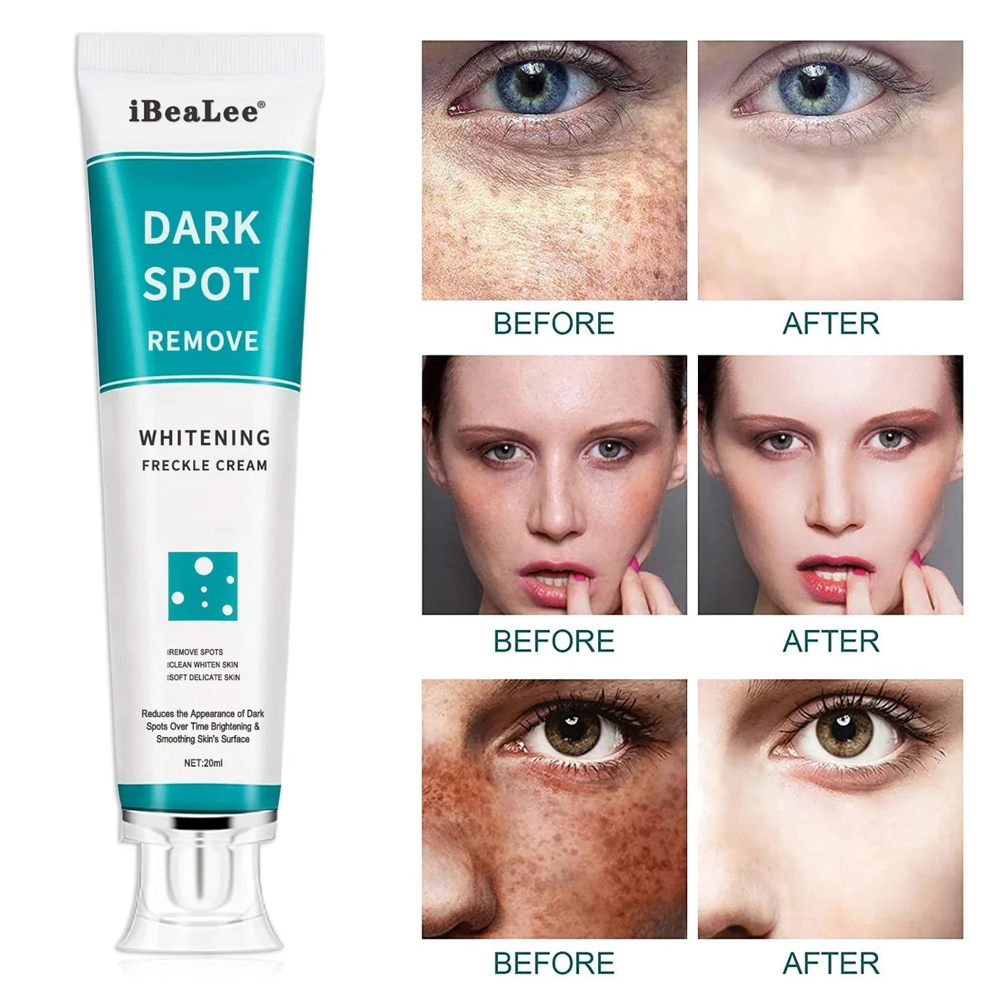 Dark Spots Remover