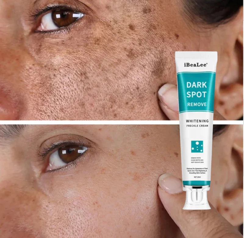 Dark Spots Remover