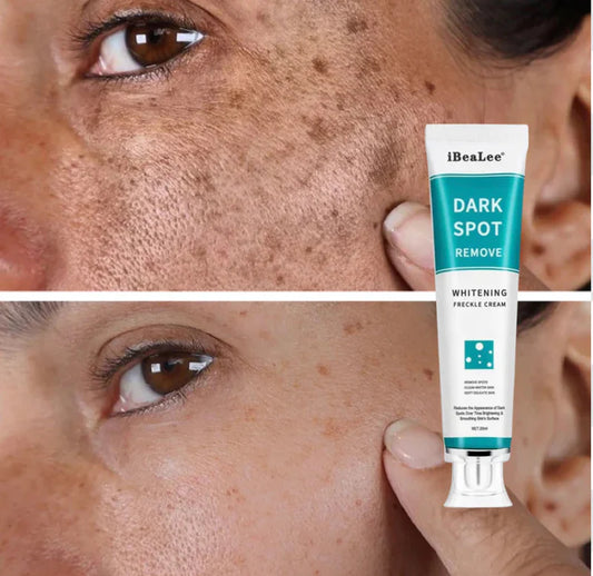 Dark Spots Remover